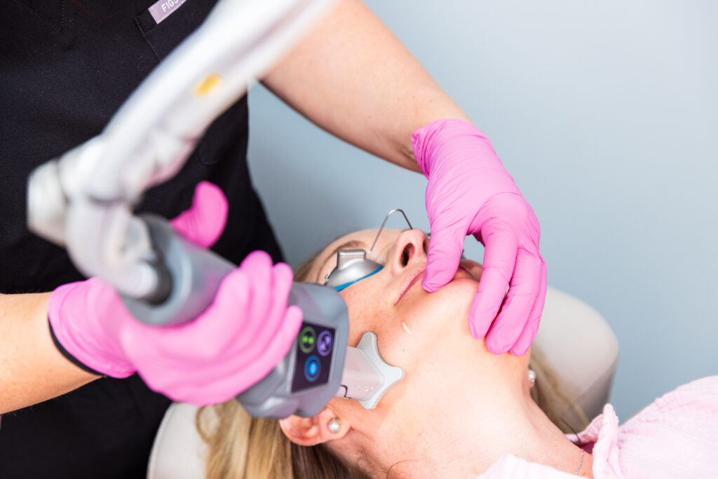 A patient, wearing specialized protective eyewear, lies on her back as she receives her ablative laser resurfacing in Tallahassee. Her provider, wearing surgical gloves, guides the handheld laser device over the patient's jaw to resurface the skin.